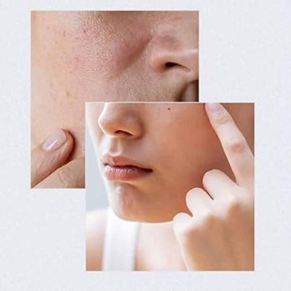 Anua Birch 70 Moisture Boosting Serum